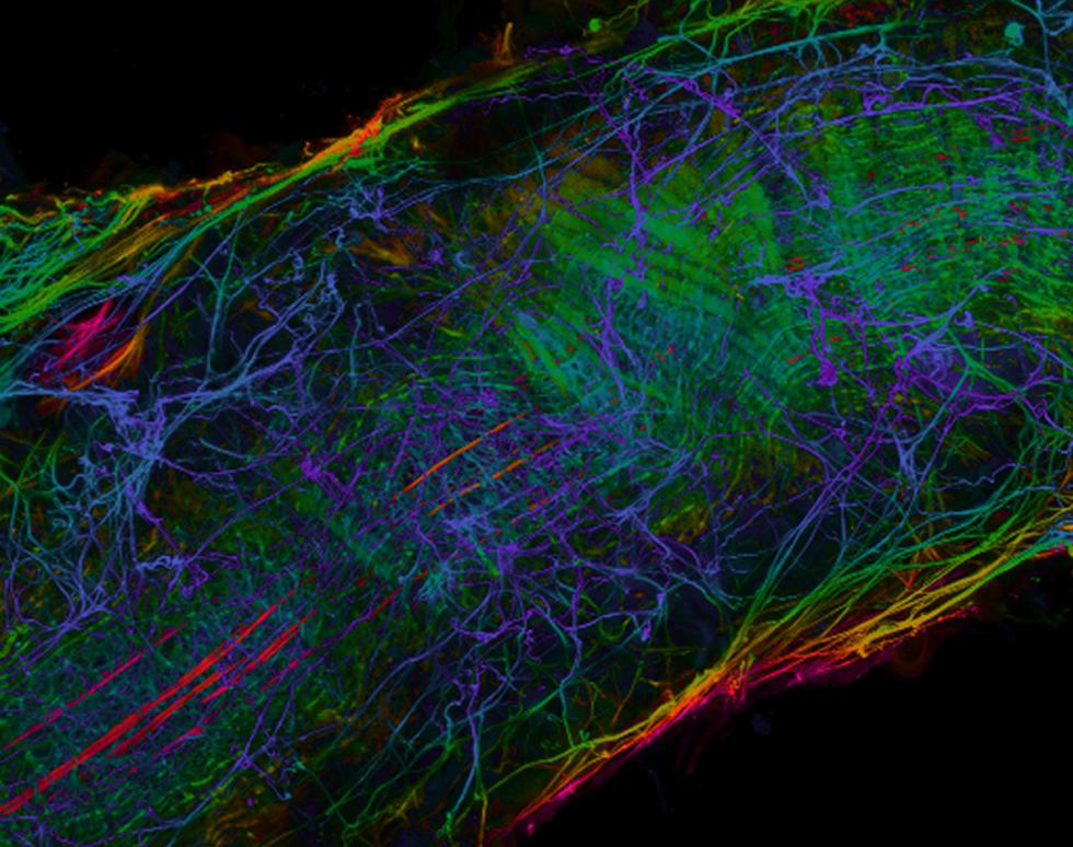 Nanofibres in situ - Priya Etherijan